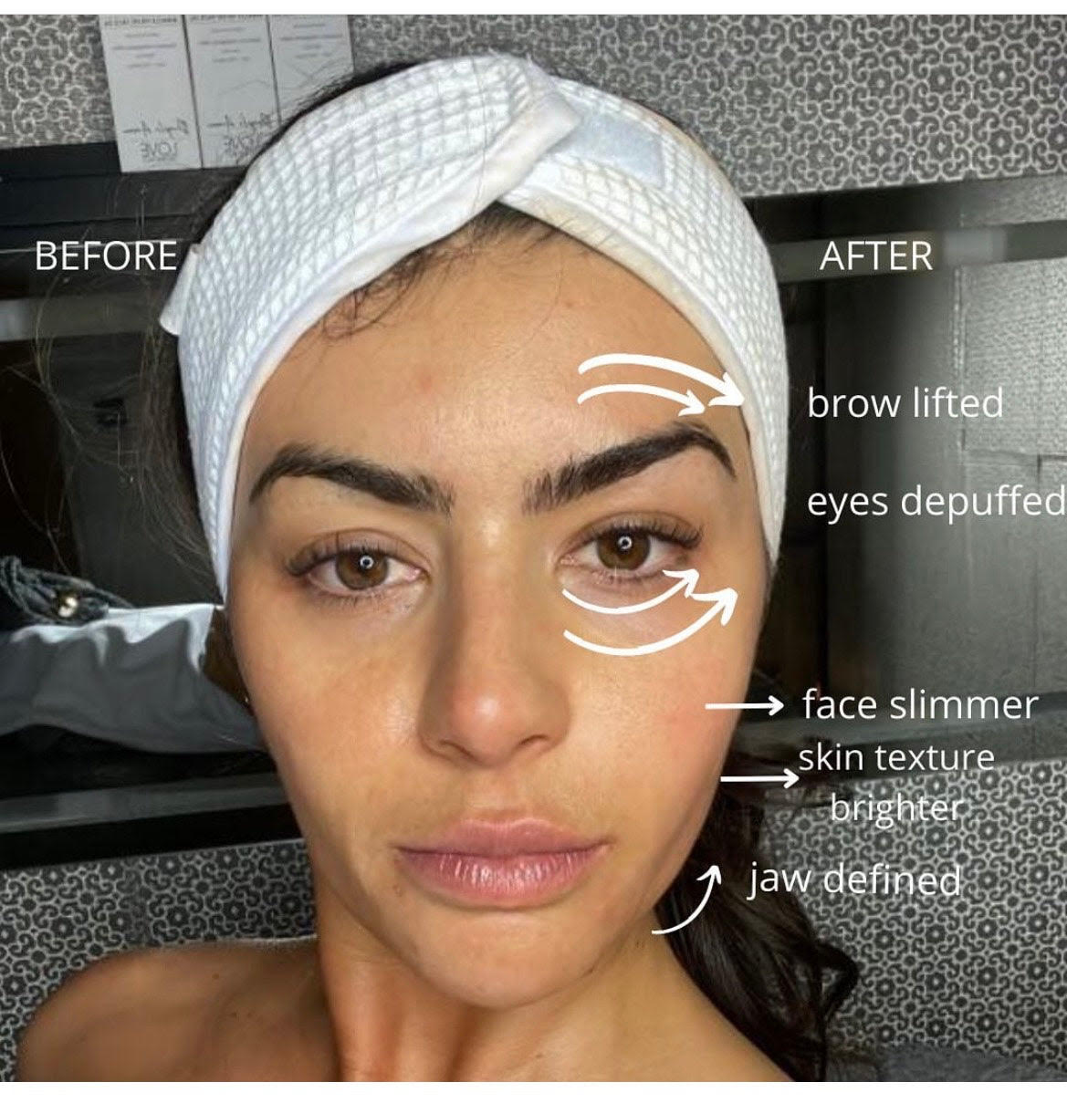 Face Left Facial ( Facial Massage + Facial Lefting )